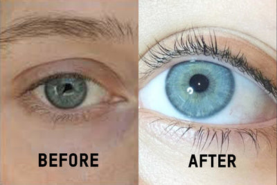 Nourishlash eyelash growth serum before and after